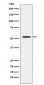 Anti-MMP1 Rabbit Monoclonal Antibody
